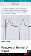 ECGCardio screenshot 8