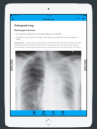 CXR FlashCards - Reference app for Chest X-rays screenshot 7