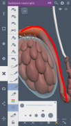 Male Pelvis: 3D RT - Sub screenshot 4