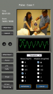 心电图节律和脉搏 screenshot 7