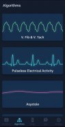 ACLS Rhythms and Quiz screenshot 1