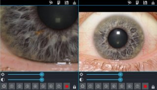 Augendiagnose screenshot 0