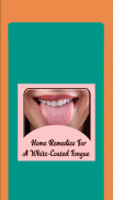Home Remedies For A White-Coated Tongue screenshot 3