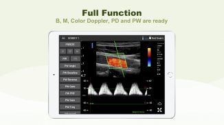 LELTEK Ultrasound - LeSono screenshot 1