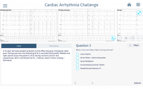 Cardiac Arrhythmia Challenge screenshot 8