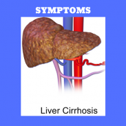 Liver Cirrhosis screenshot 4