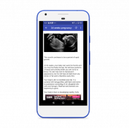 Ultrasound pregnancy guide screenshot 0