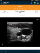Clarius Ultrasound App screenshot 11
