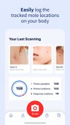 AI Dermatologist: Skin Scanner screenshot 0