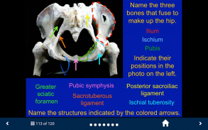 MSK Anatomy - SecondLook screenshot 1