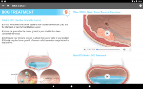 BCG Treatment screenshot 3