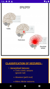 Medical Surgical Nursing screenshot 10