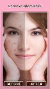 面部瑕疵卸妆 - 光滑的皮肤和美化面孔 screenshot 5
