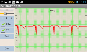 Mobile patient monitoring screenshot 7