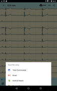 DiaCard - ECG Recorder screenshot 5