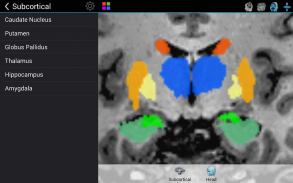 Brain Tutor 3D screenshot 14