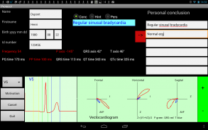 Mobile ecg recording screenshot 4