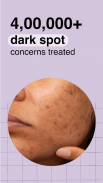 Cureskin: Skin & Hair Experts screenshot 4