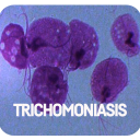 Trichomoniasis Disease