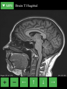 MRI Viewer screenshot 6