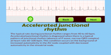 ECG Rhythm Quiz screenshot 6