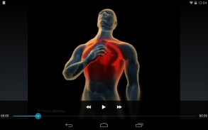 AQR - Cardiac events screenshot 4