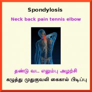 Spondylosis Spondylitis screenshot 2