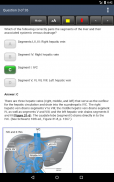 Schwartz's Surgery ABSITE and Board Review, 10/E screenshot 8