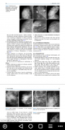 Oncoplastic and Reconstructive Breast Surgery screenshot 3