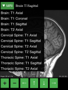 MRI Viewer screenshot 9