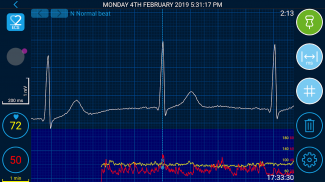 Beat2Phone ECG screenshot 0