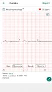 EMAY Portable ECG Monitor screenshot 0