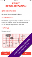 ECG FlashCards 2 Lite - Free Reference EKG App screenshot 8