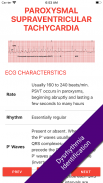 ECG FlashCards 2 Lite - Free Reference EKG App screenshot 0