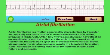 ECG Rhythm screenshot 2