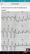 ECGCardio screenshot 3