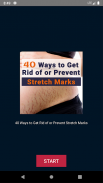 40 Ways to Get Rid of or Prevent Stretch Marks screenshot 2