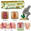 Hemorrhoid & Treatment