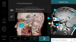 Human Anatomy Atlas 17 (Org.) screenshot 1