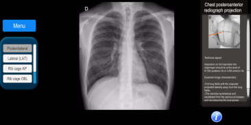 Radiographic Anatomy X-Ray screenshot 2