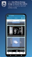 Philips CT Learning screenshot 5