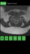 MRI Viewer screenshot 3
