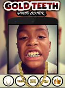 Gold Teeth Photo Editor screenshot 2