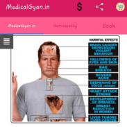 MedicalGyan - Homeopathy Medicine , MCQs ,Organon screenshot 2