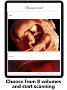ScanBaby learn baby ultrasound screenshot 4