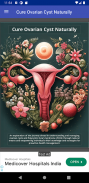 Cure Ovarian Cysts Naturally screenshot 2