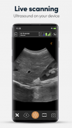 Clarius Ultrasound App screenshot 4