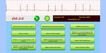 ECG Rhythm Quiz screenshot 0