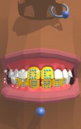 Dentist Bling screenshot 4