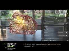 INSIGHT HEART screenshot 12